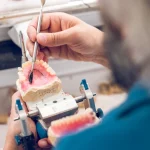 Your Guide to Dentures on the Central Coast